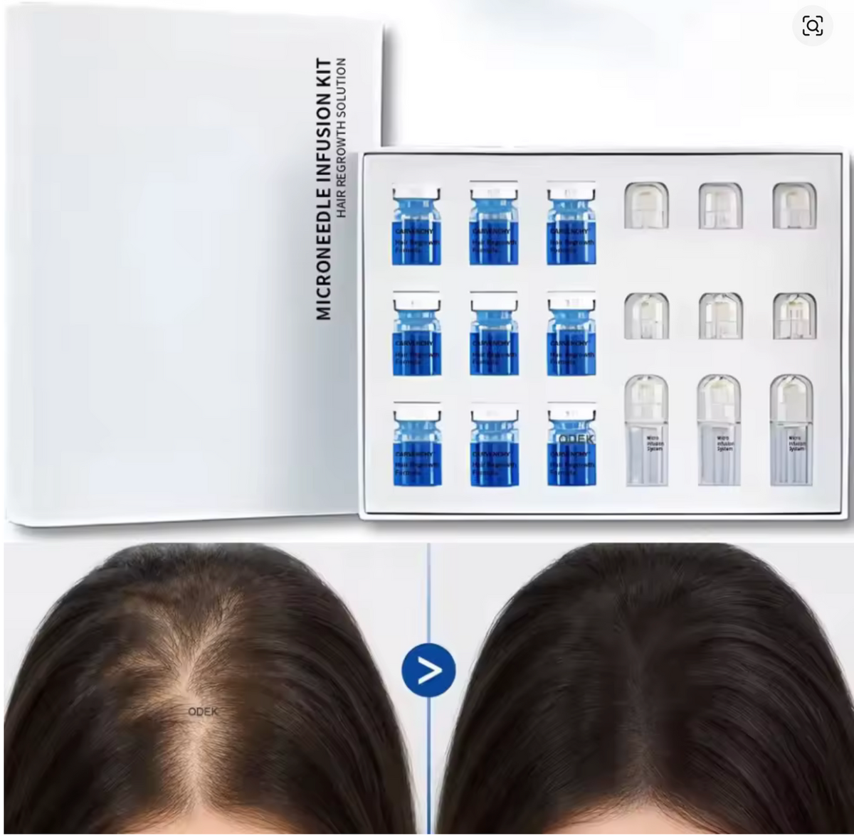 Microneedling Hair &  Scalp Serum Care Kit
